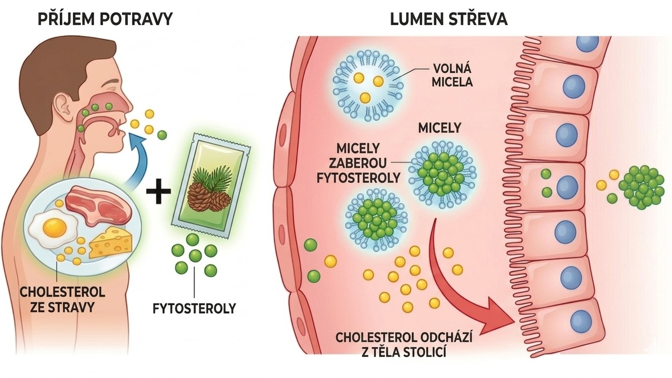 Schéma ukazuje příjem potravy s cholesterolem a fytosteroly, které společně putují do trávicího traktu. V lumen střeva fytosteroly obsazují transportní micely, čímž vytlačují volný cholesterol, který následně přirozeně odchází z těla stolicí.